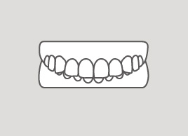 深い噛み合わせの歯並び