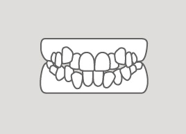 ガタガタの歯並び